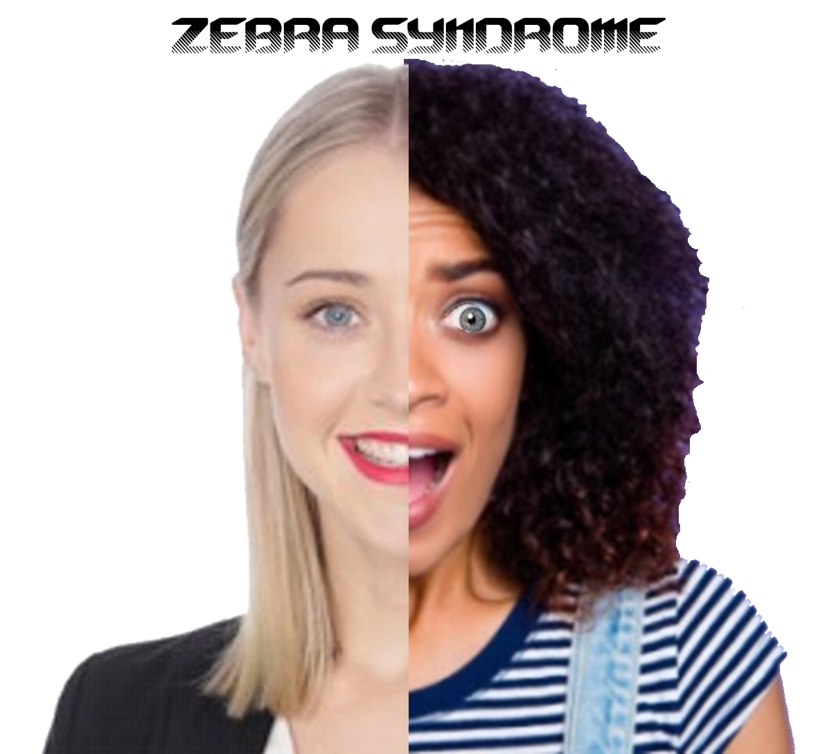 zebra syndrome